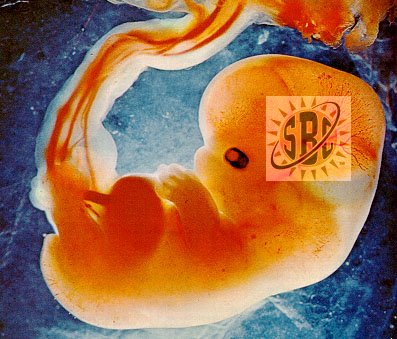 sun belt conference fetus